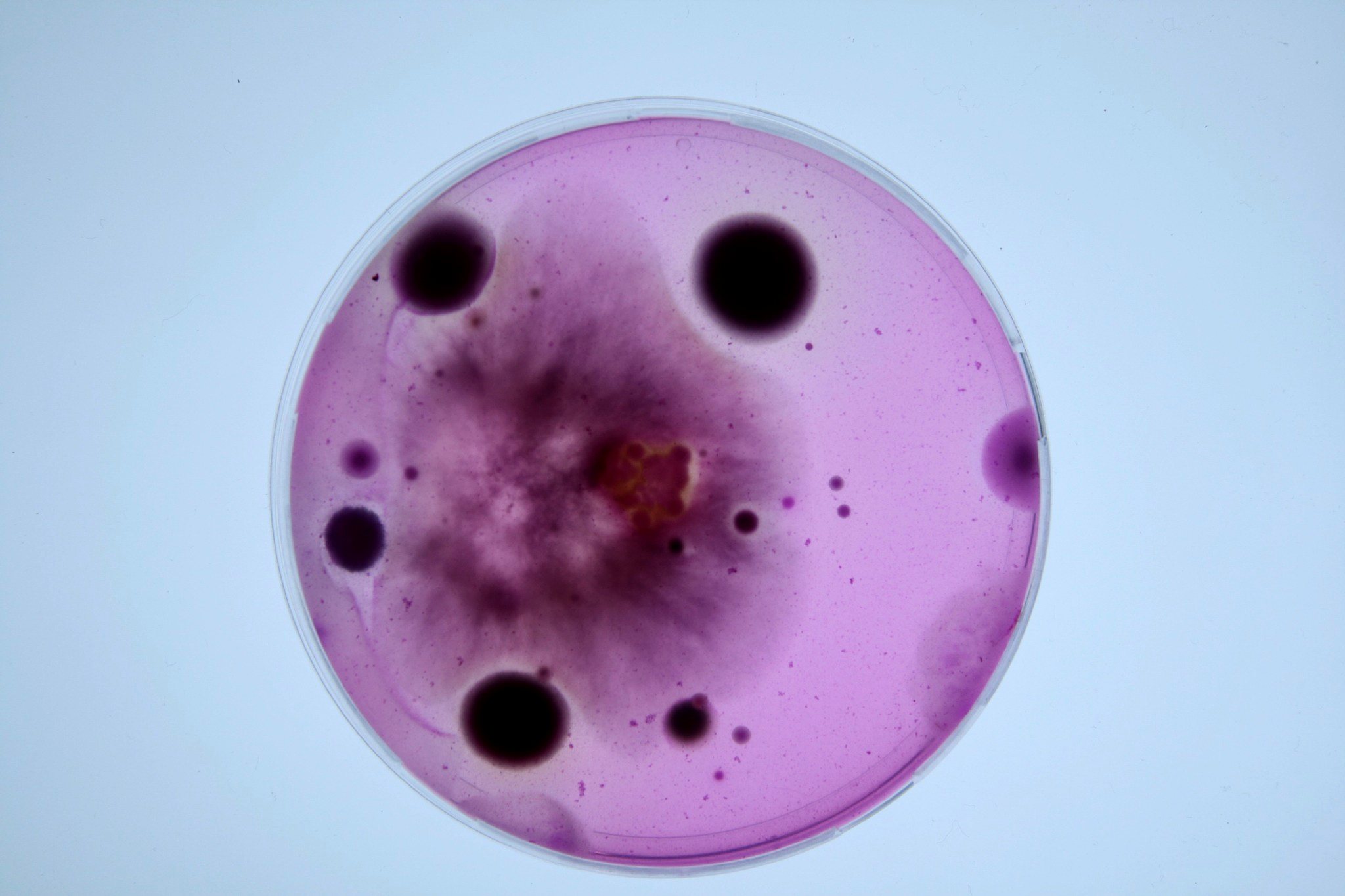 Boîte de Petri - analyse microbiologique